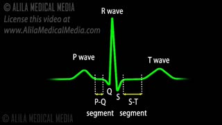 Cardiac Conduction System and Understanding ECG, Animation.